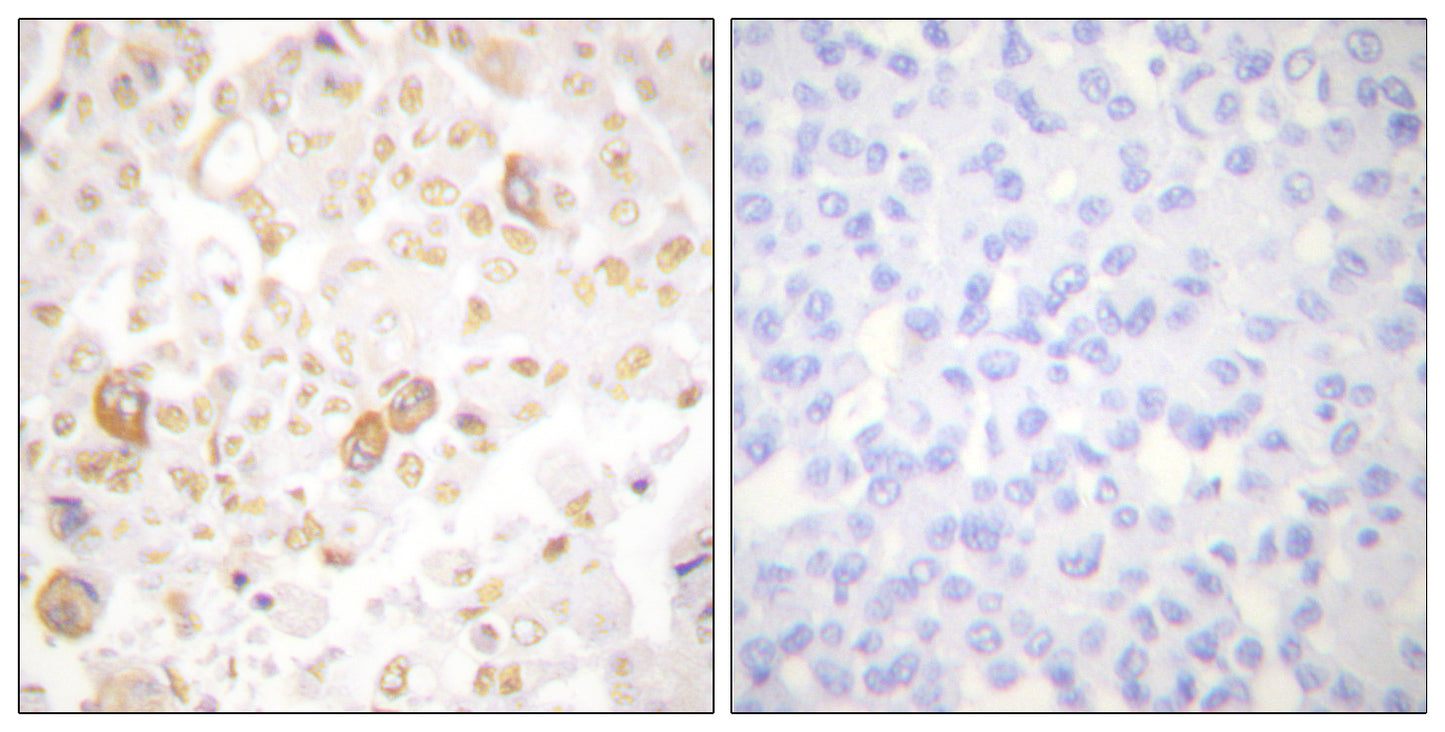Cyclin F Rabbit Polyclonal Antibody