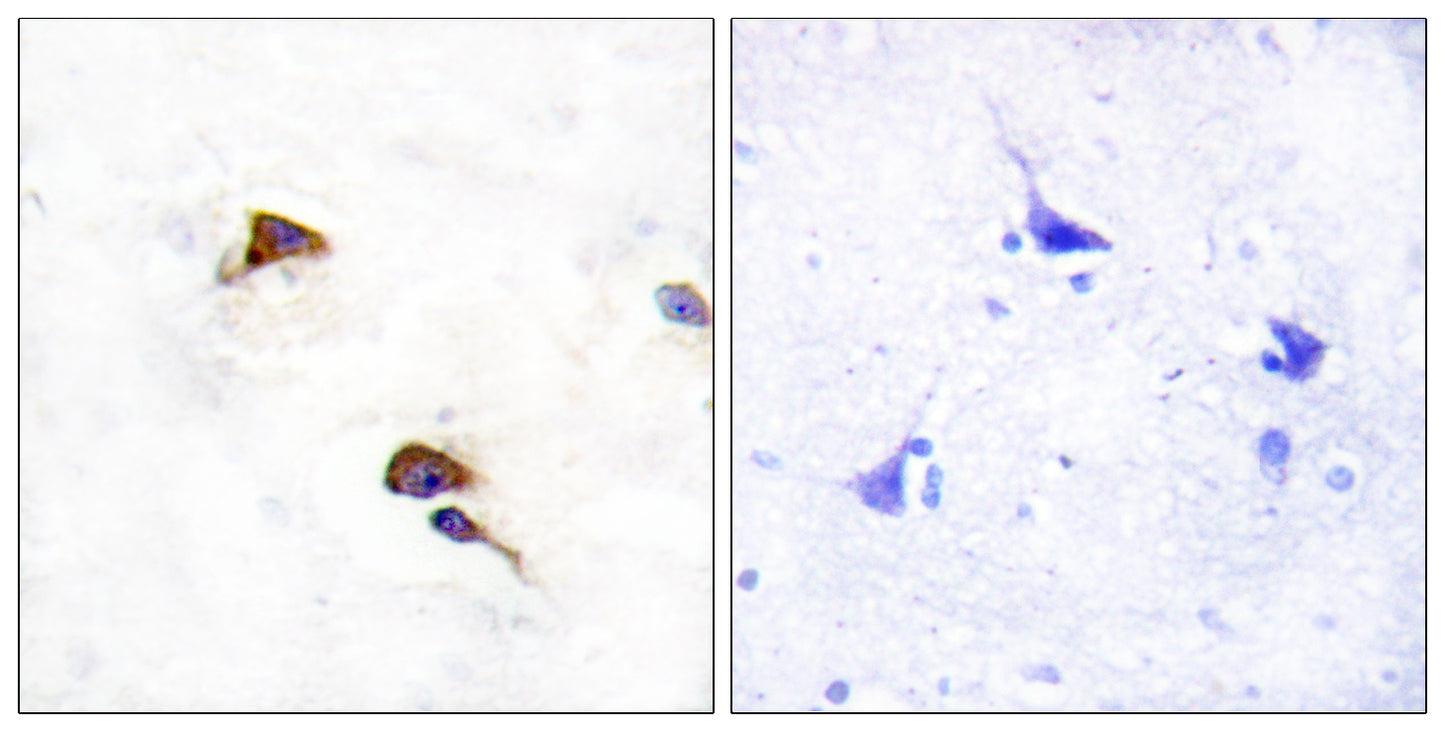 Cyclophilin F Rabbit Polyclonal Antibody
