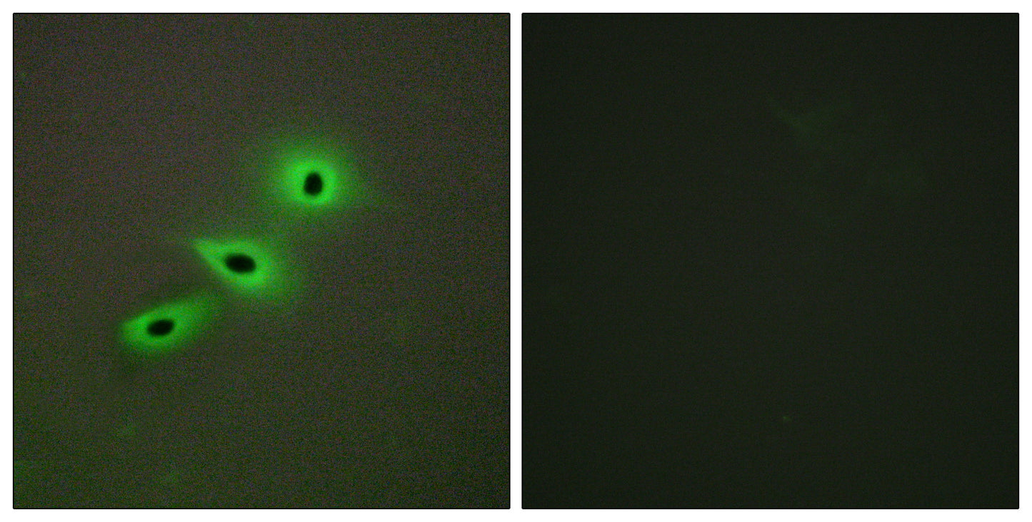 CYP19A1 Rabbit Polyclonal Antibody