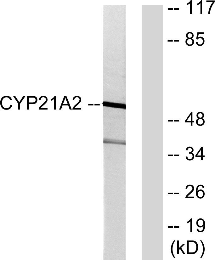 CYP21A2 Rabbit Polyclonal Antibody