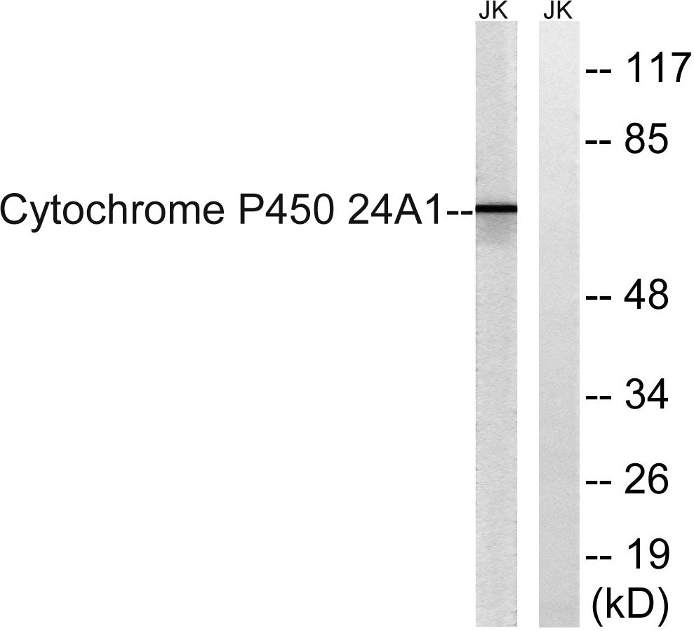 CYP24A1 Rabbit Polyclonal Antibody