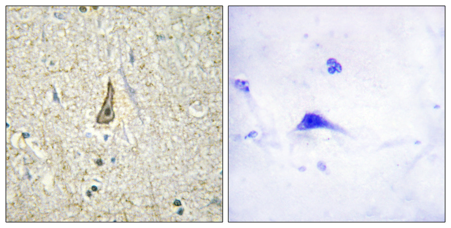 CYP26C1 Rabbit Polyclonal Antibody