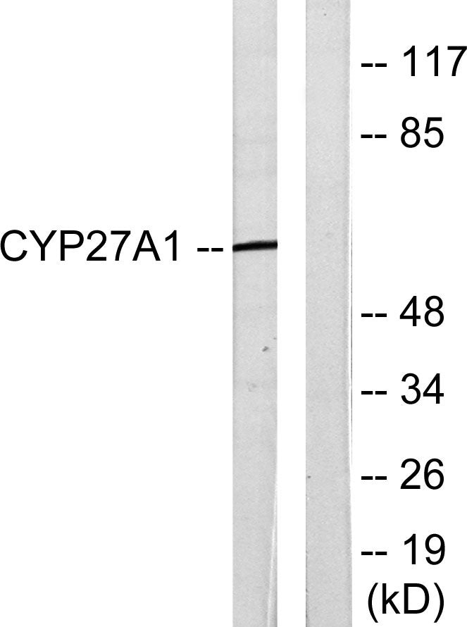 CYP27A1 Rabbit Polyclonal Antibody