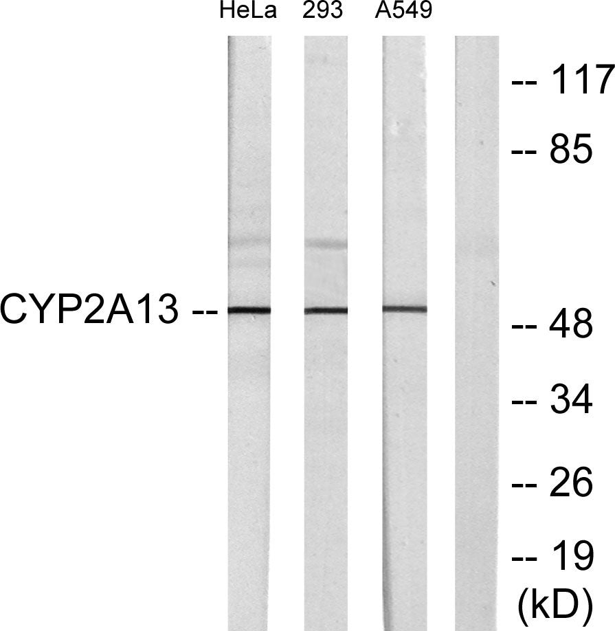 CYP2A13 Rabbit Polyclonal Antibody