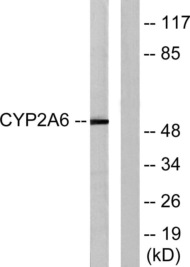 CYP2A6 Rabbit Polyclonal Antibody