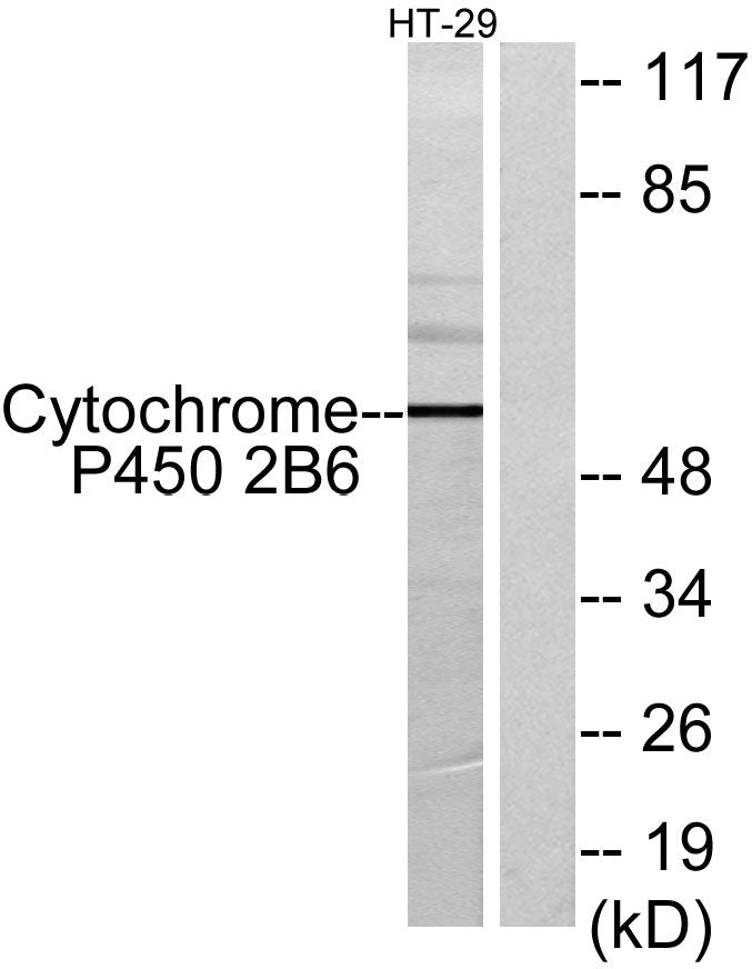 CYP2B6 Rabbit Polyclonal Antibody