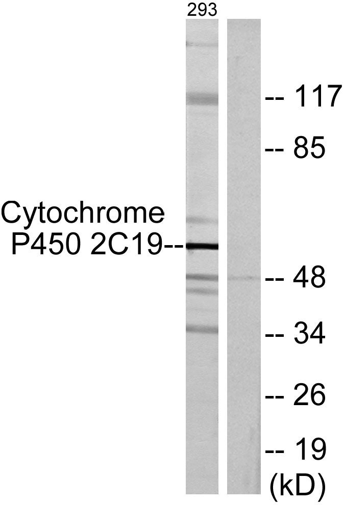 CYP2C19 Rabbit Polyclonal Antibody