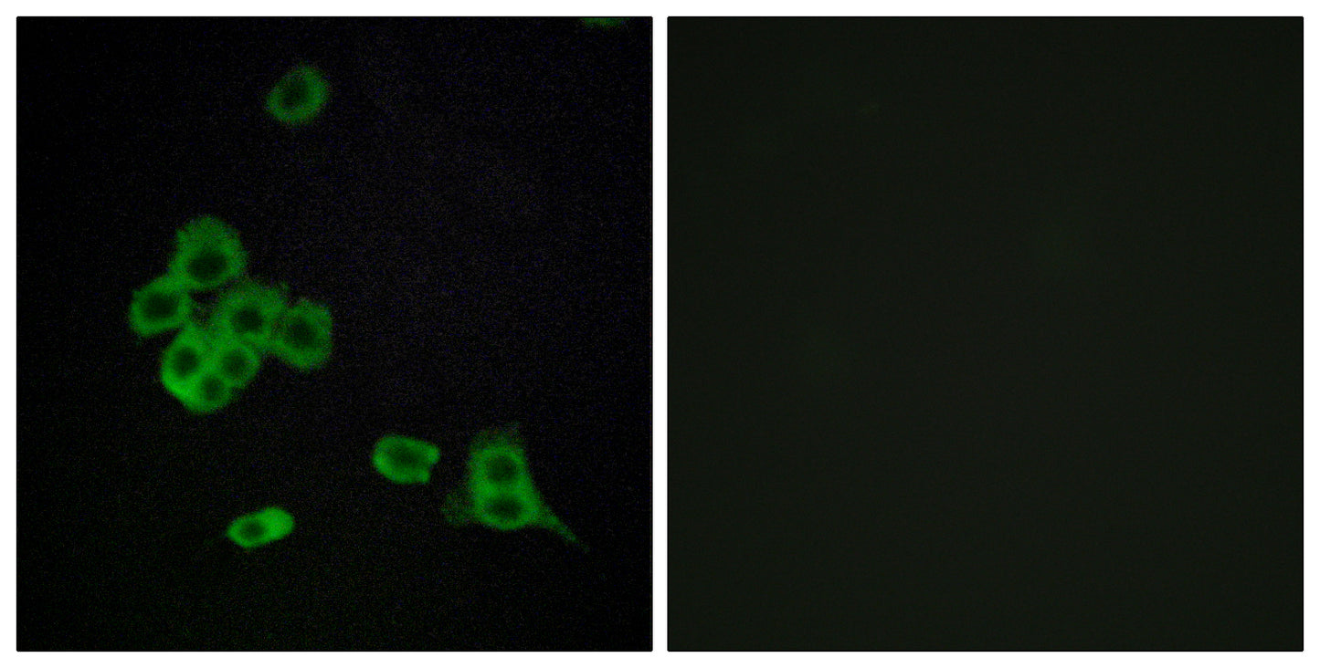 CYP2C8 Rabbit Polyclonal Antibody