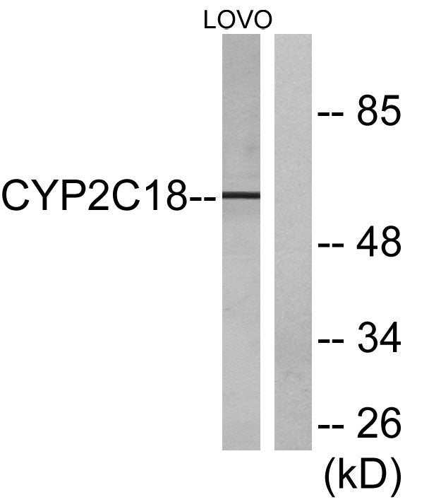 CYP2C8/9/18/19 Rabbit Polyclonal Antibody