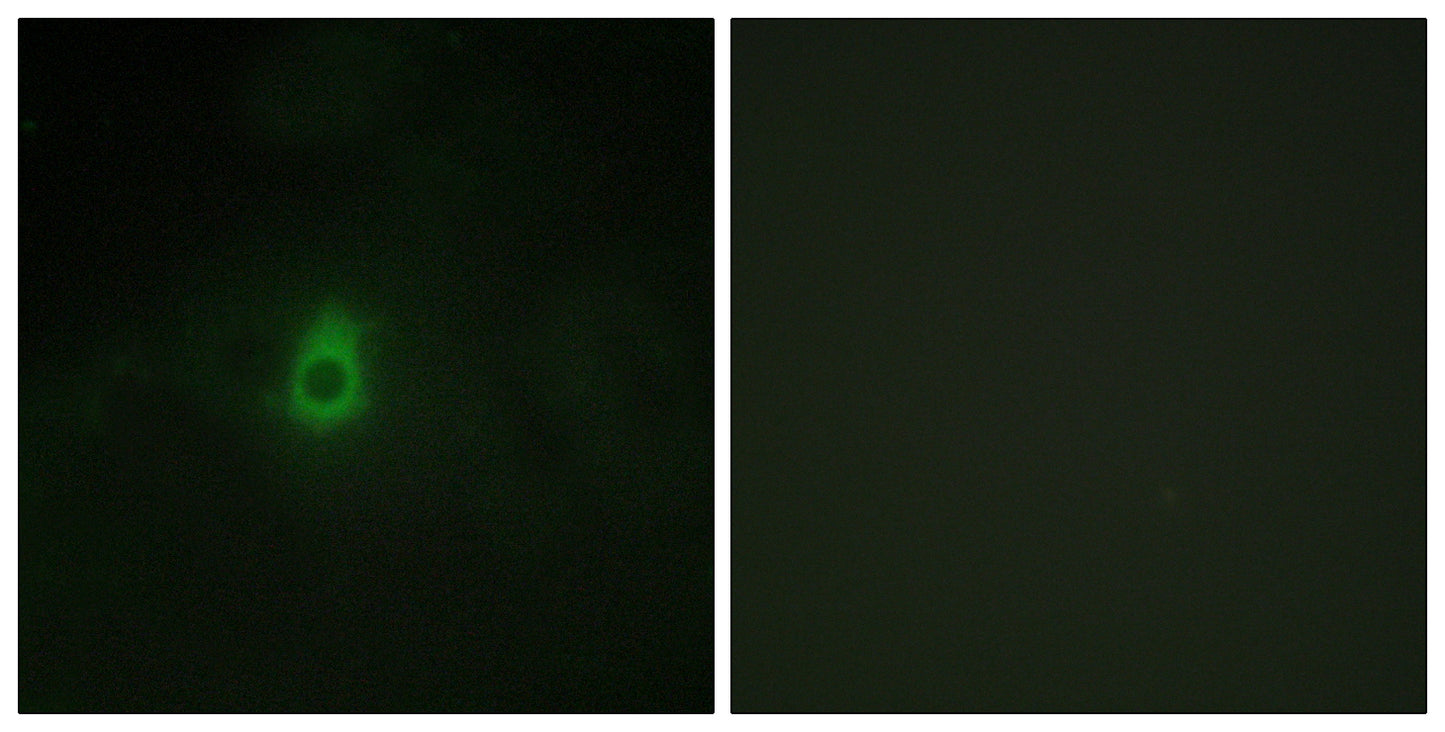 CYP2E1 Rabbit Polyclonal Antibody