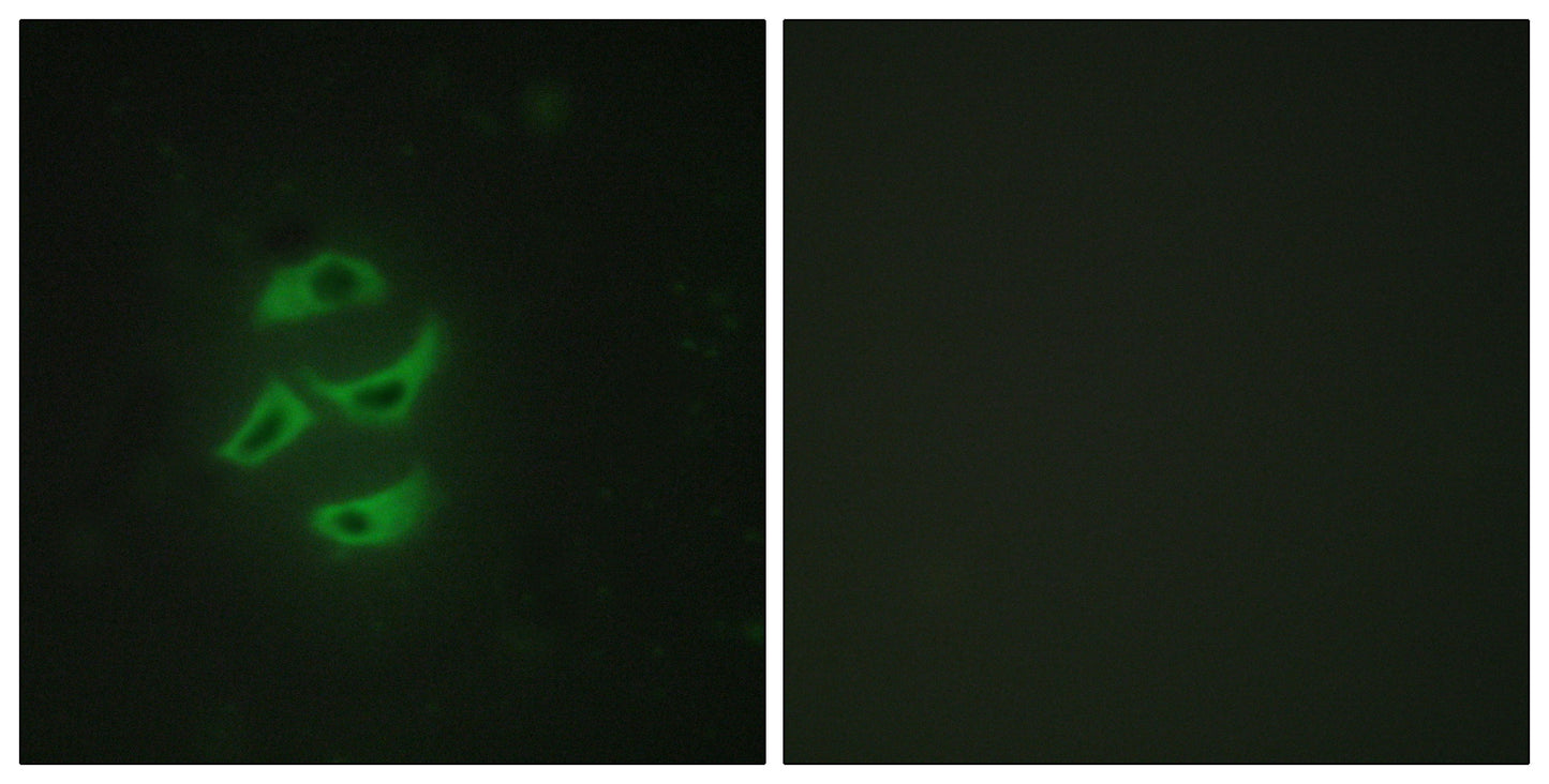 CYP2J2 Rabbit Polyclonal Antibody