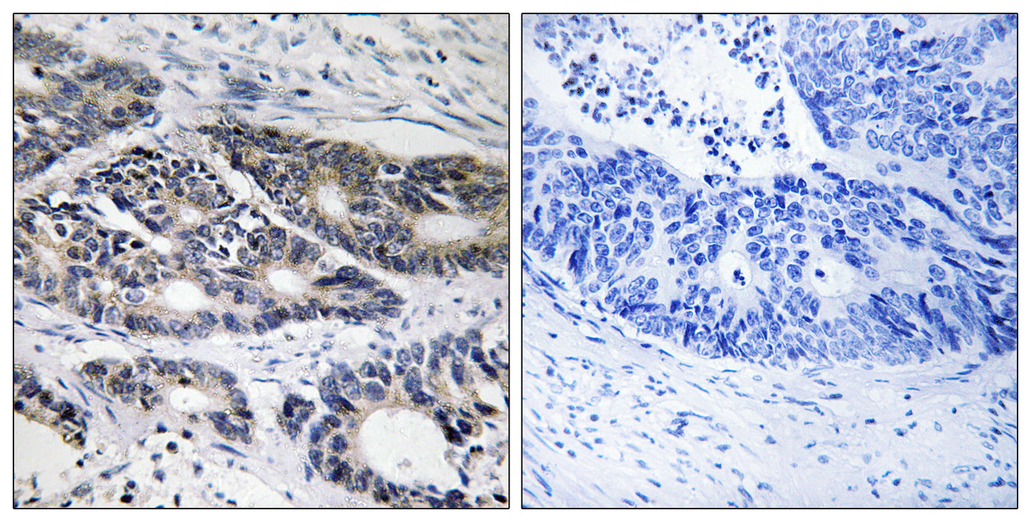 CYP2R1 Rabbit Polyclonal Antibody