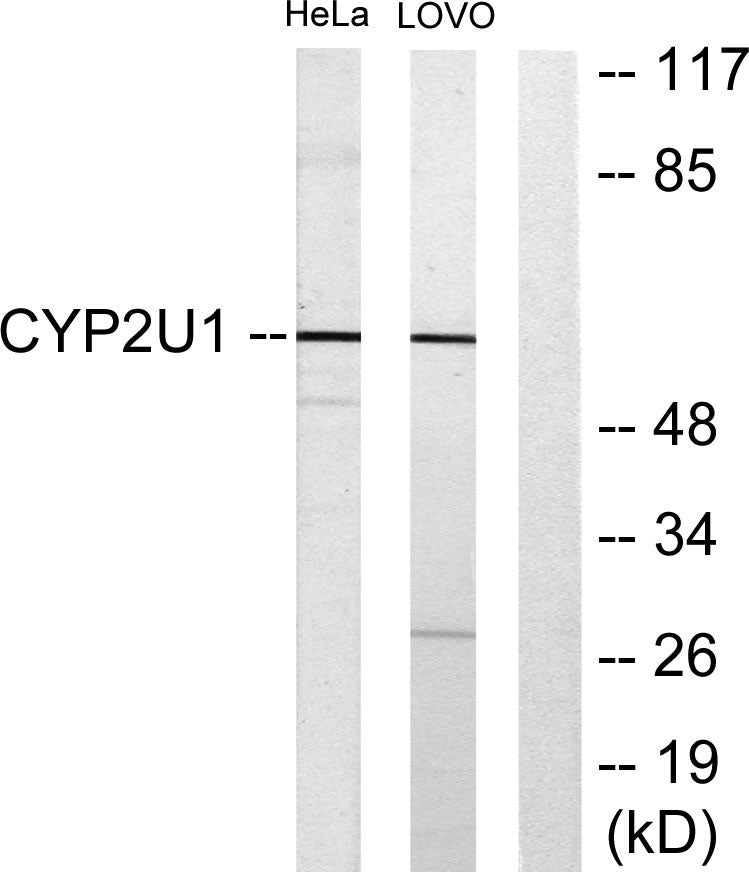 CYP2U1 Rabbit Polyclonal Antibody