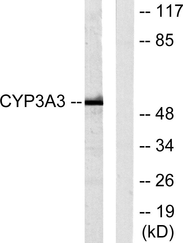 CYP3A4/5 Rabbit Polyclonal Antibody