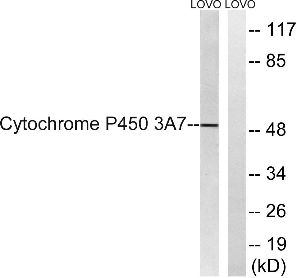 CYP3A7 Rabbit Polyclonal Antibody