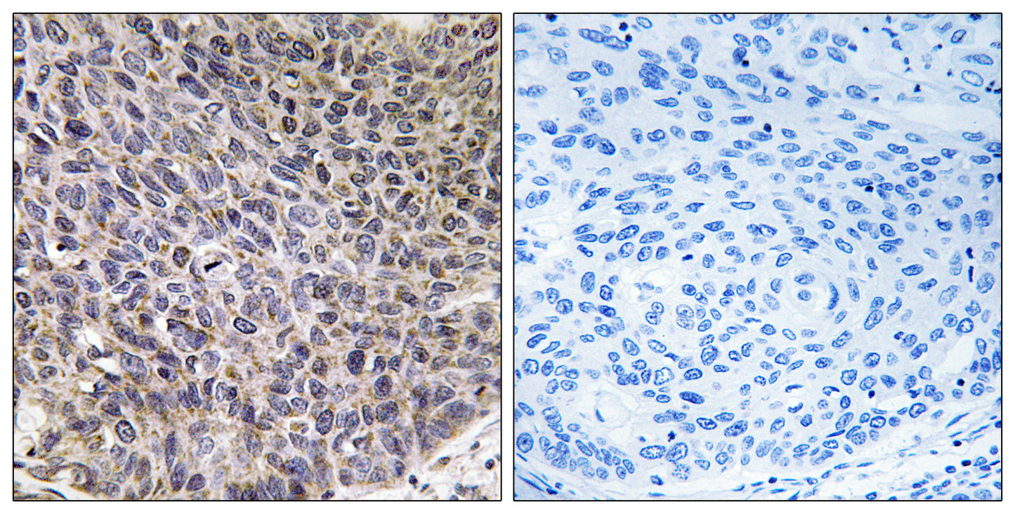 CYP4B1 Rabbit Polyclonal Antibody