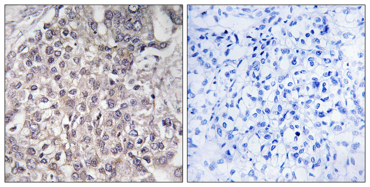 CYP4F2 Rabbit Polyclonal Antibody