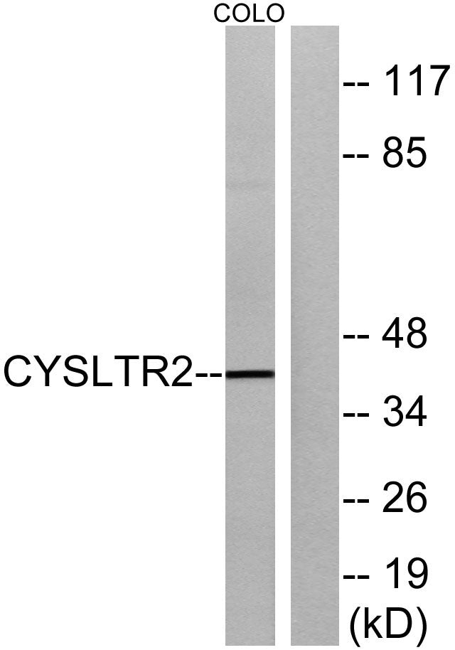 CysLTR2 Rabbit Polyclonal Antibody