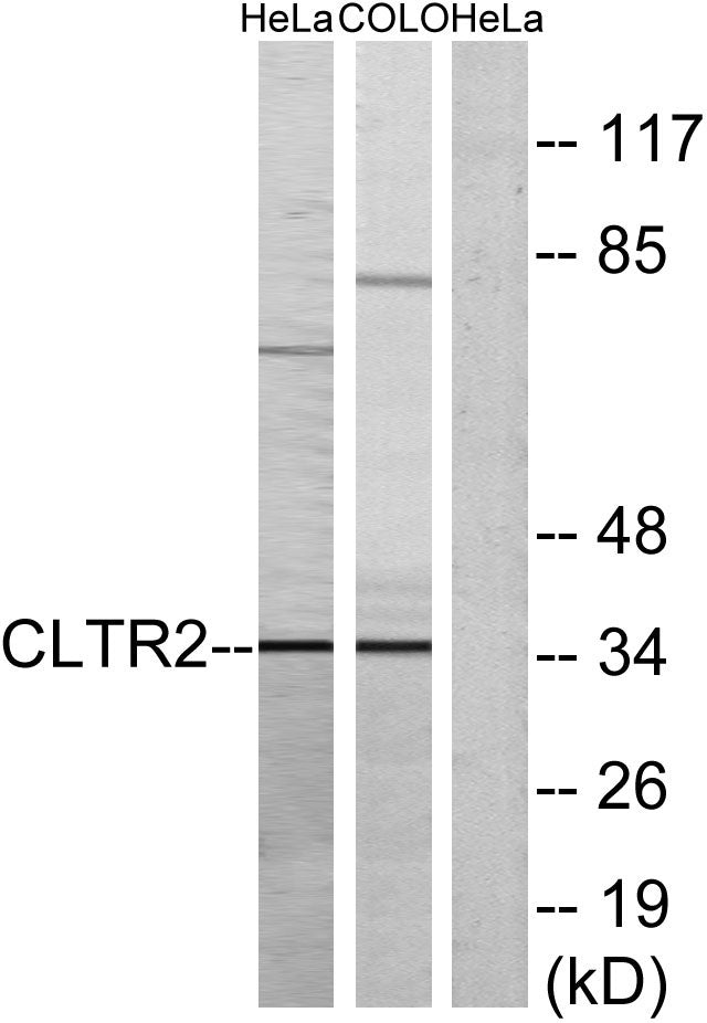 CysLTR2 Rabbit Polyclonal Antibody