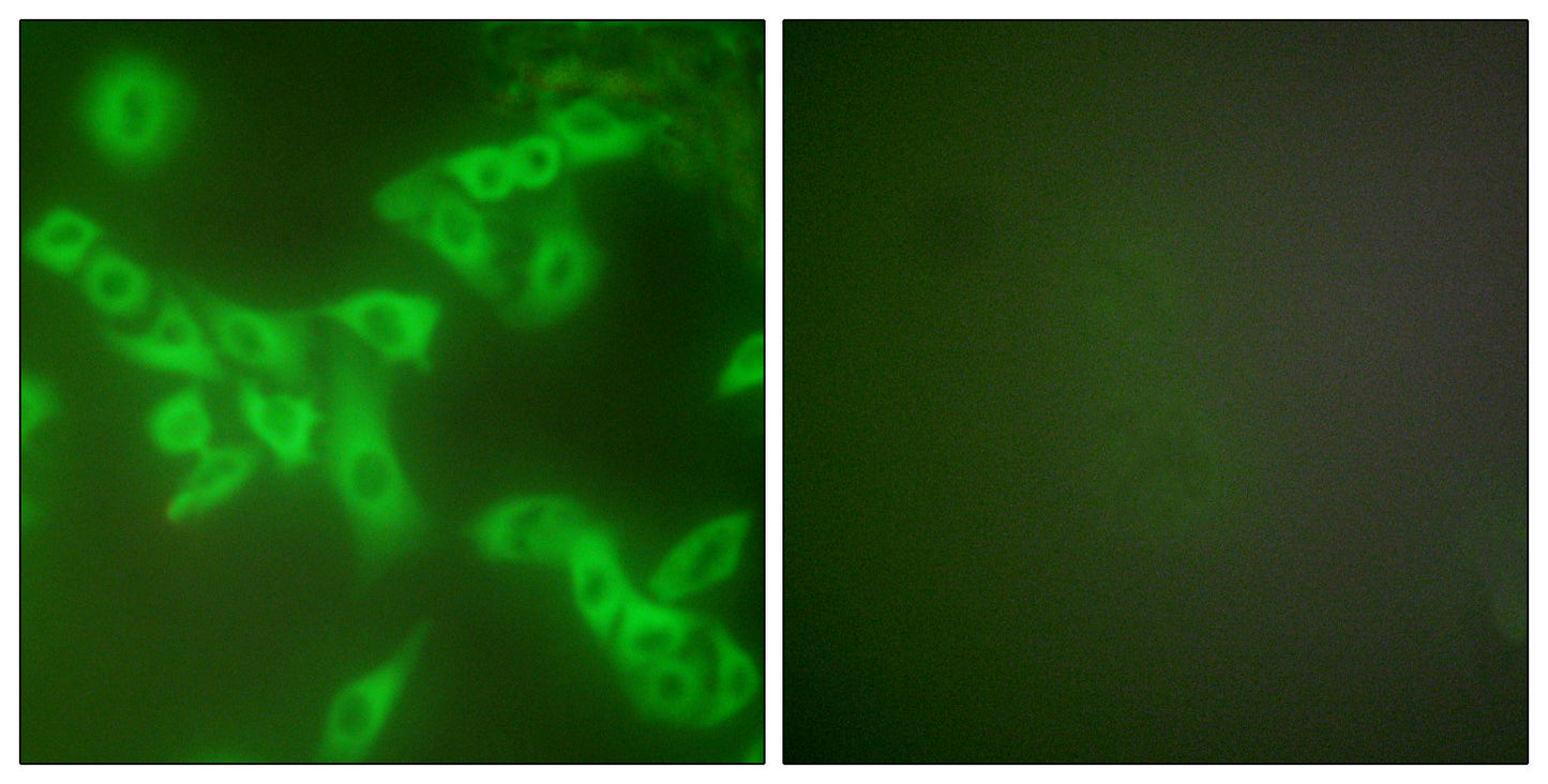 Cystatin B Rabbit Polyclonal Antibody