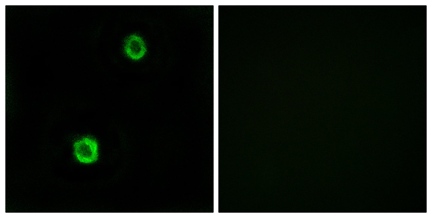 Cystatin SN Rabbit Polyclonal Antibody