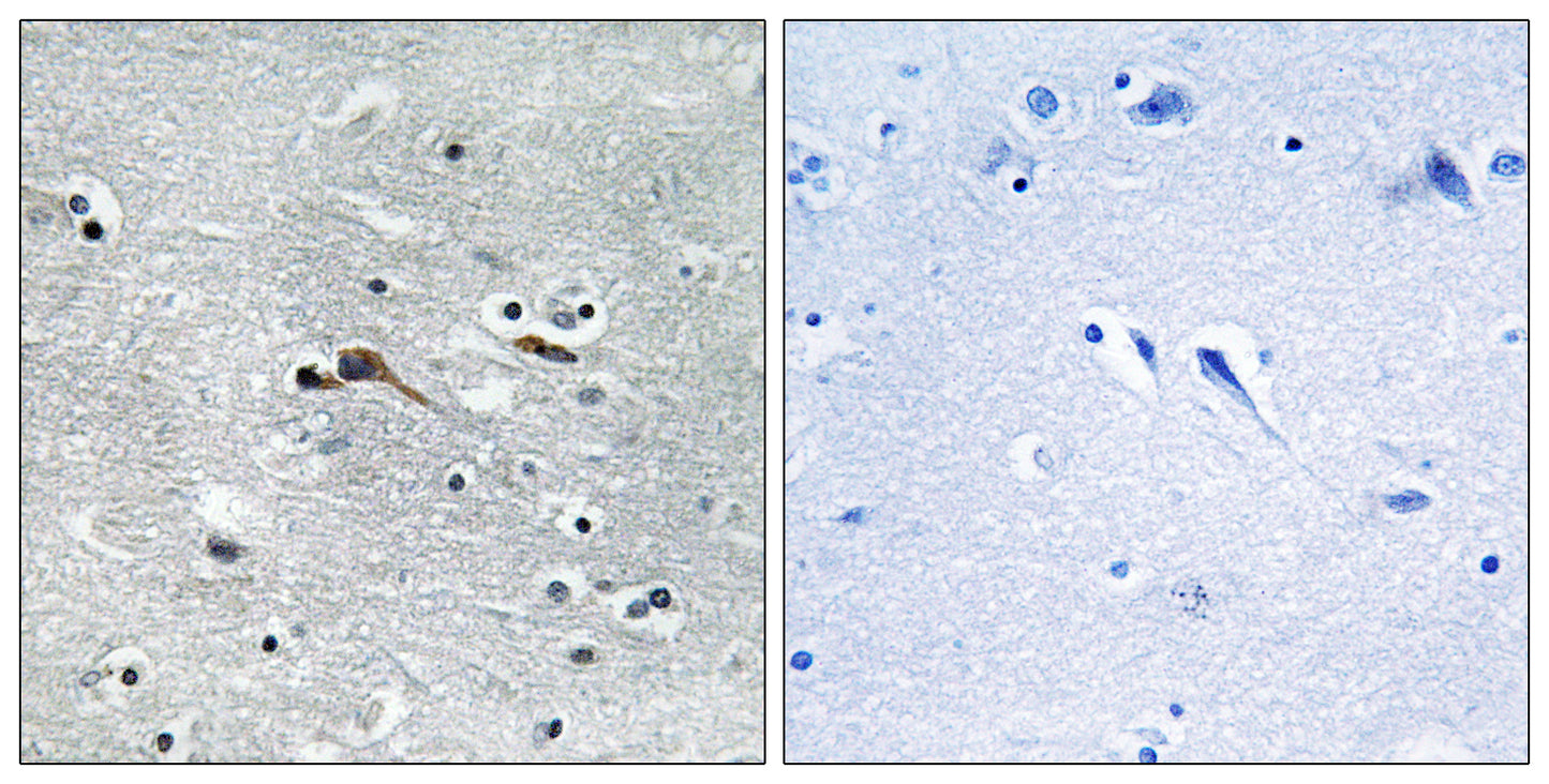 CYTL1 Rabbit Polyclonal Antibody