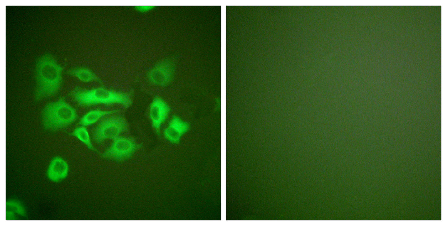 Cytokeratin 10 Rabbit Polyclonal Antibody