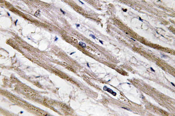 Cytokeratin 13 Rabbit Polyclonal Antibody