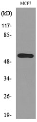 Cytokeratin 14 Rabbit Polyclonal Antibody