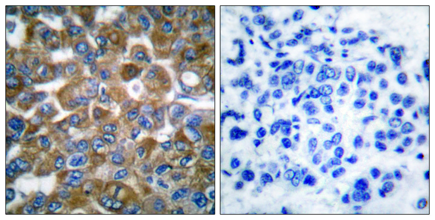 Cytokeratin 15 Rabbit Polyclonal Antibody