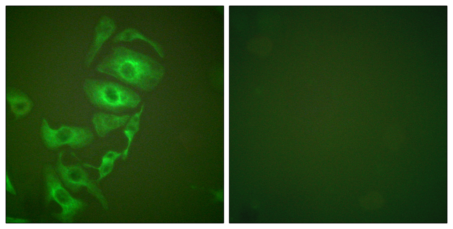 Cytokeratin 17 Rabbit Polyclonal Antibody