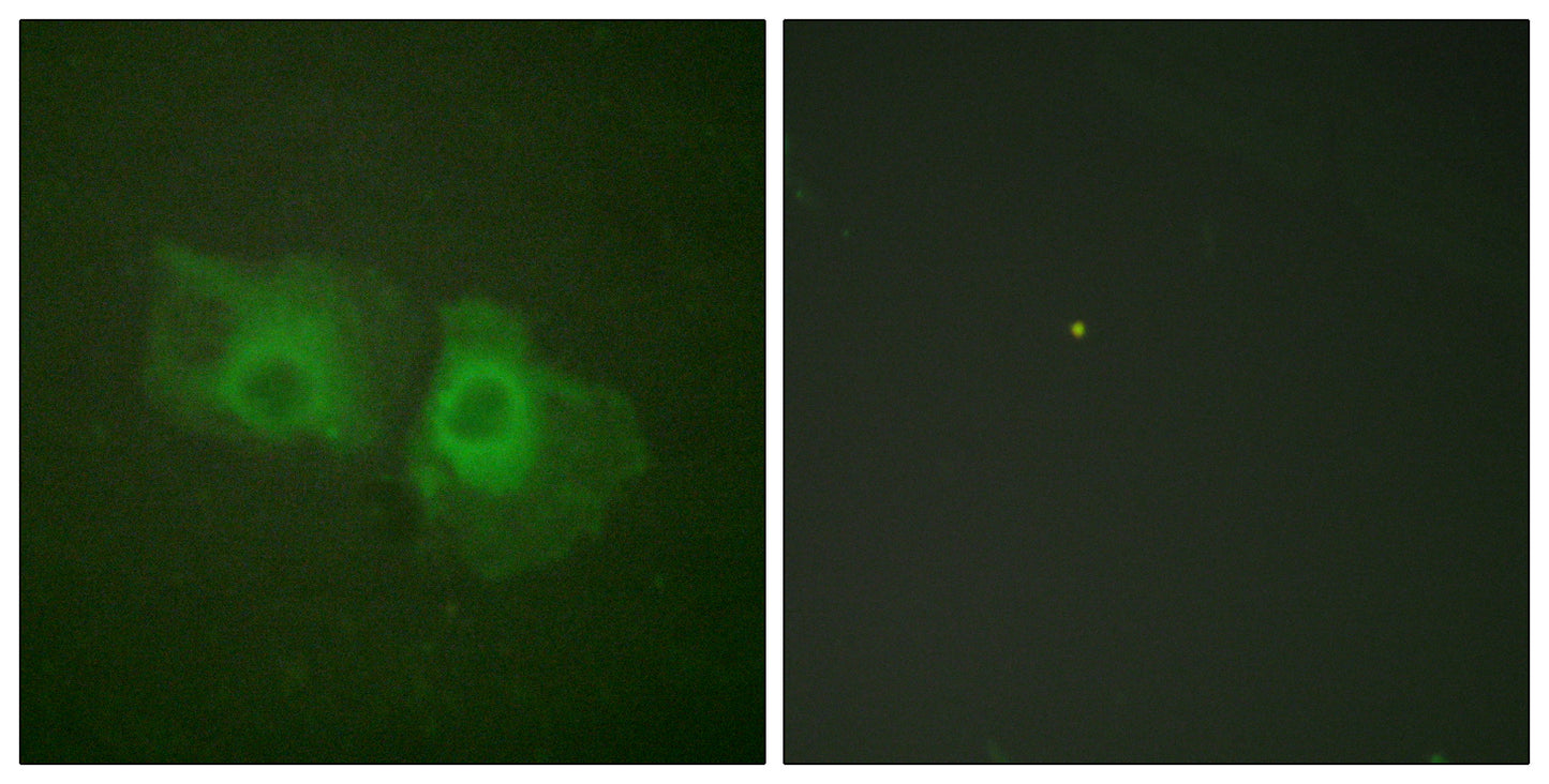 Cytokeratin 18 Rabbit Polyclonal Antibody