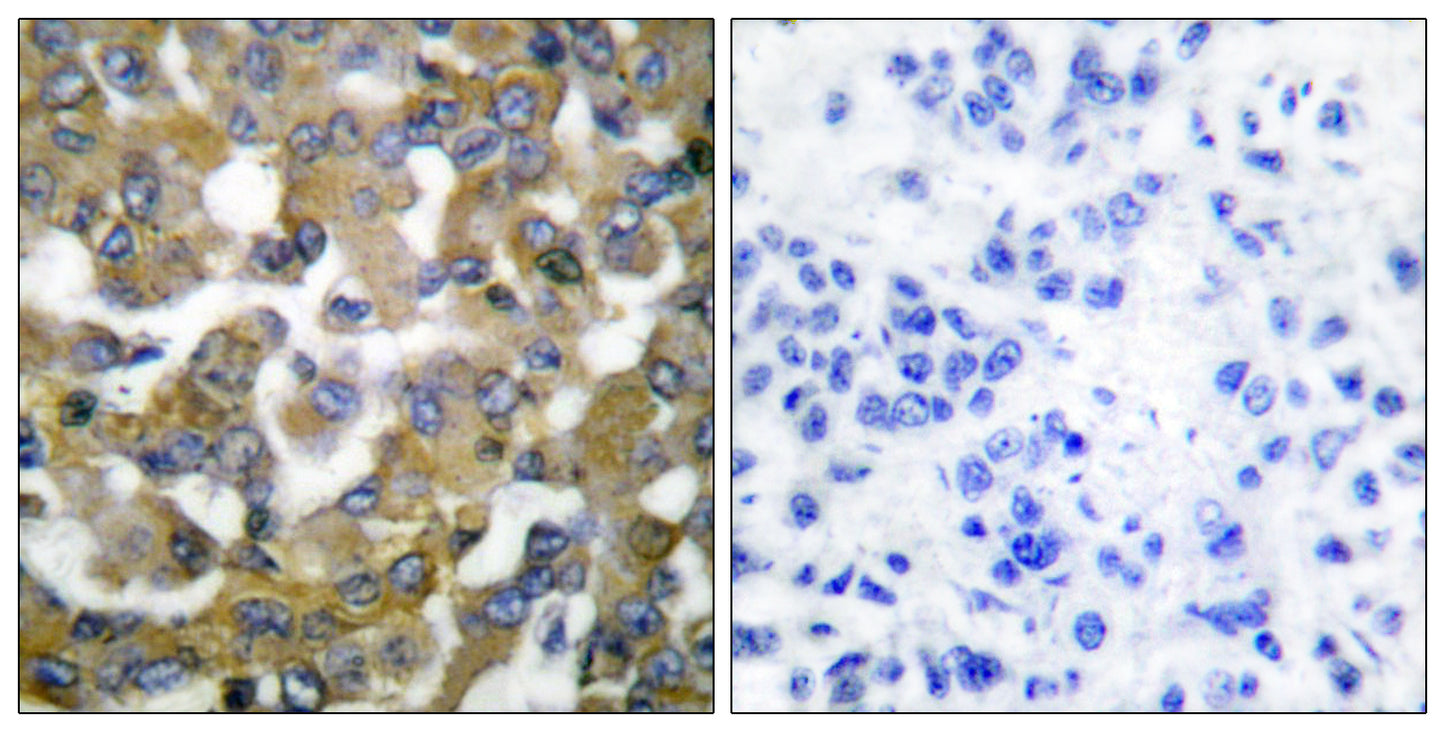 Cytokeratin 19 Rabbit Polyclonal Antibody