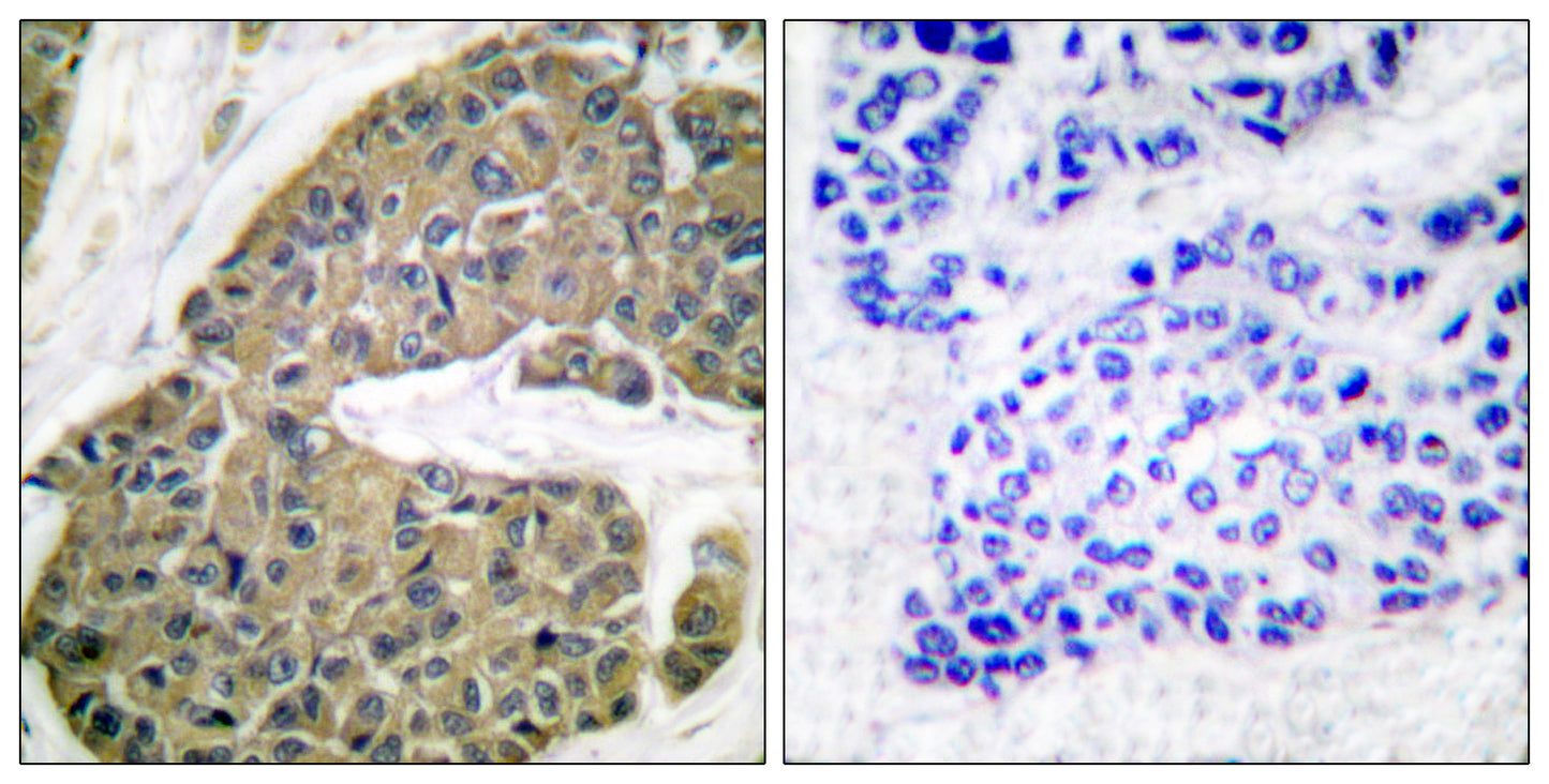 Cytokeratin 5 Rabbit Polyclonal Antibody
