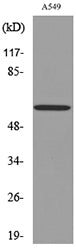 Cytokeratin 8 Rabbit Polyclonal Antibody