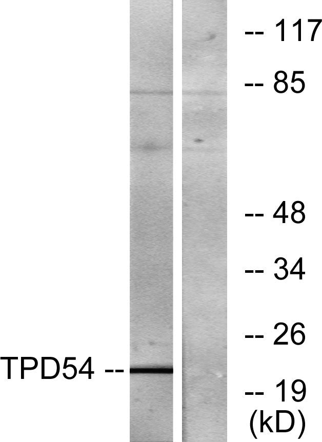 D54 Rabbit Polyclonal Antibody