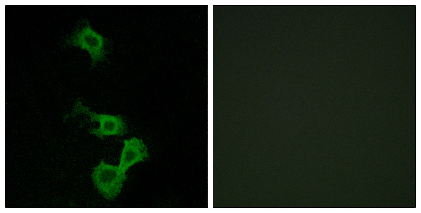 Dab1 Rabbit Polyclonal Antibody