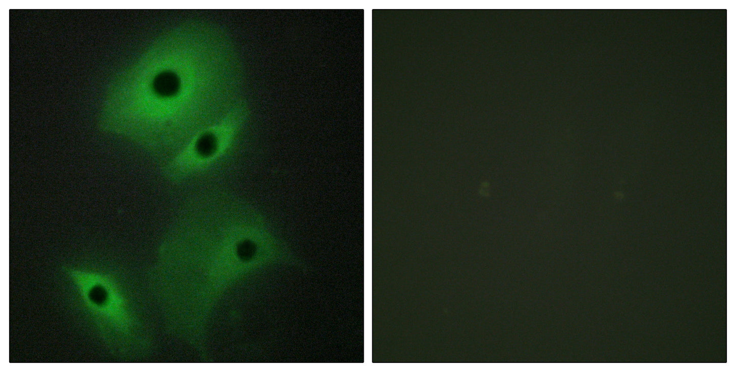 DAN Rabbit Polyclonal Antibody