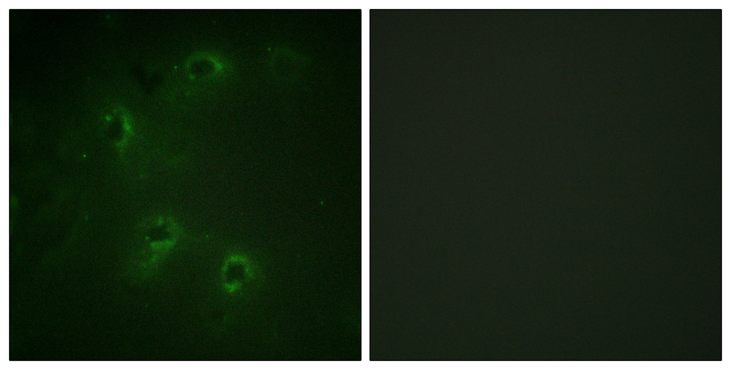 DAPK1 Rabbit Polyclonal Antibody