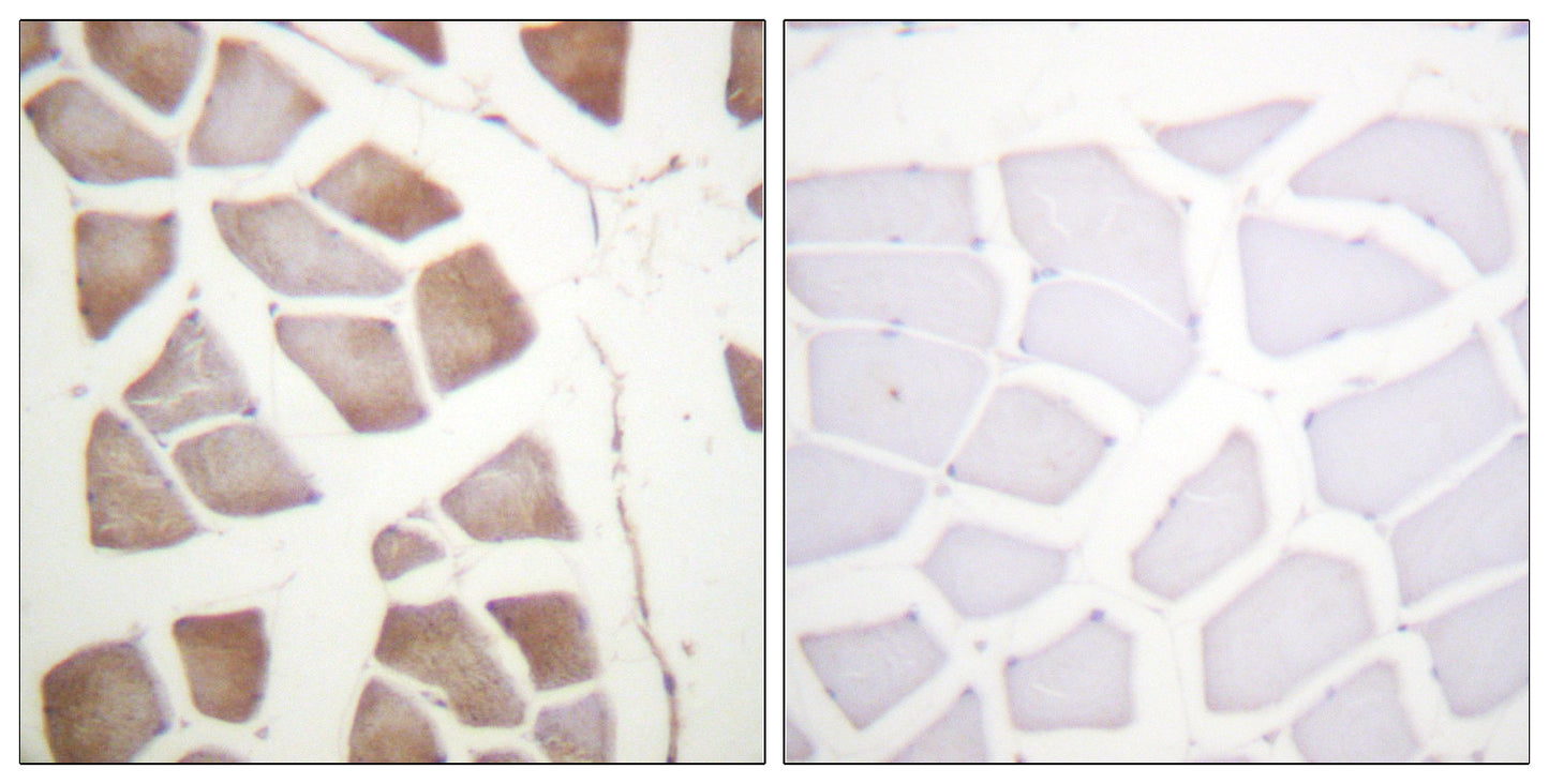 DAPK2 Rabbit Polyclonal Antibody