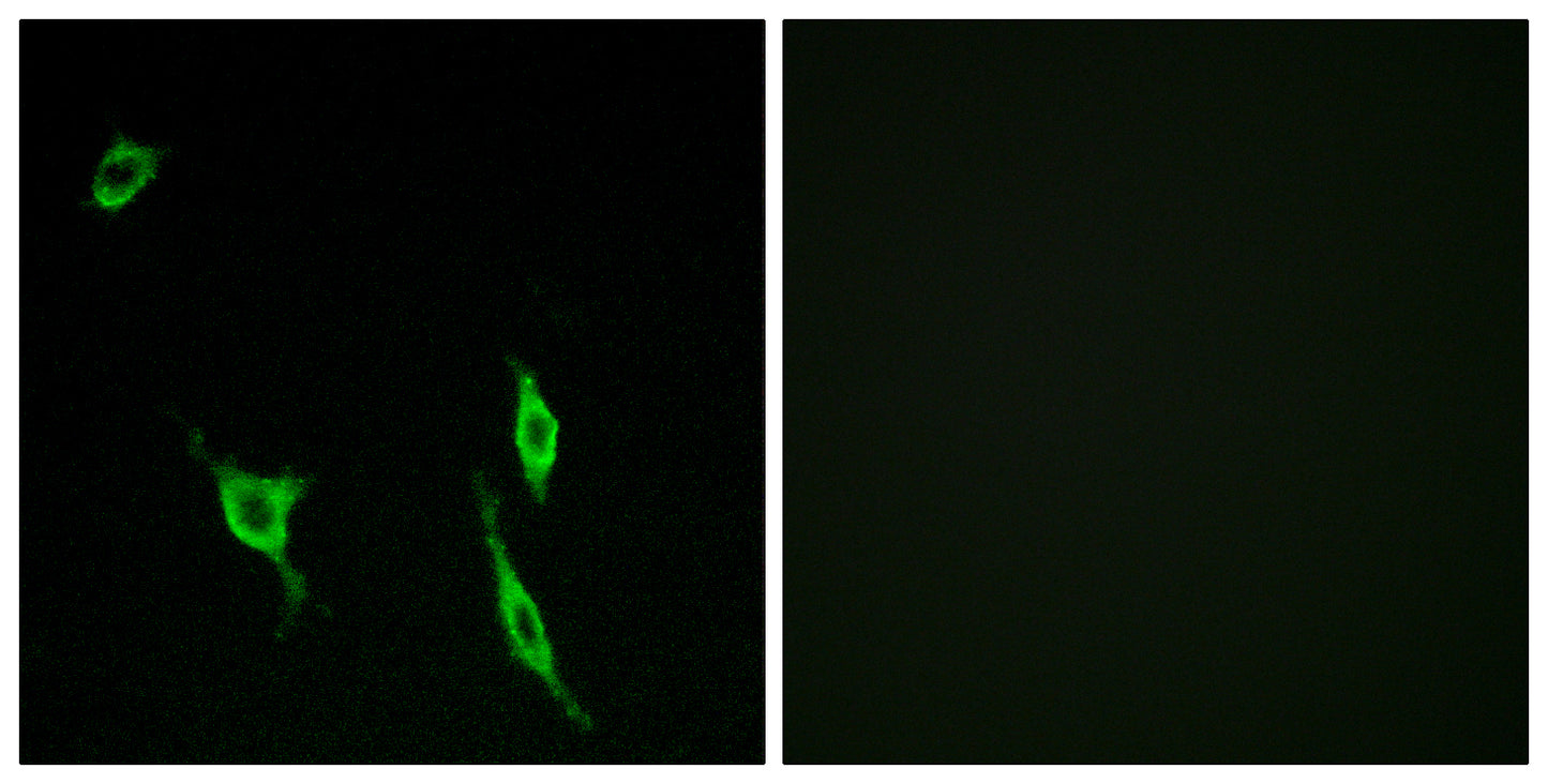 DCC Rabbit Polyclonal Antibody
