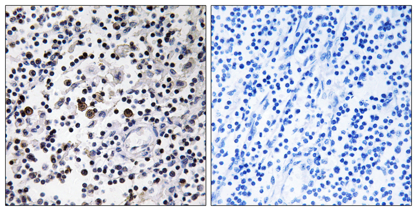 DCL-1 Rabbit Polyclonal Antibody