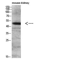 DC-LAMP Rabbit Polyclonal Antibody