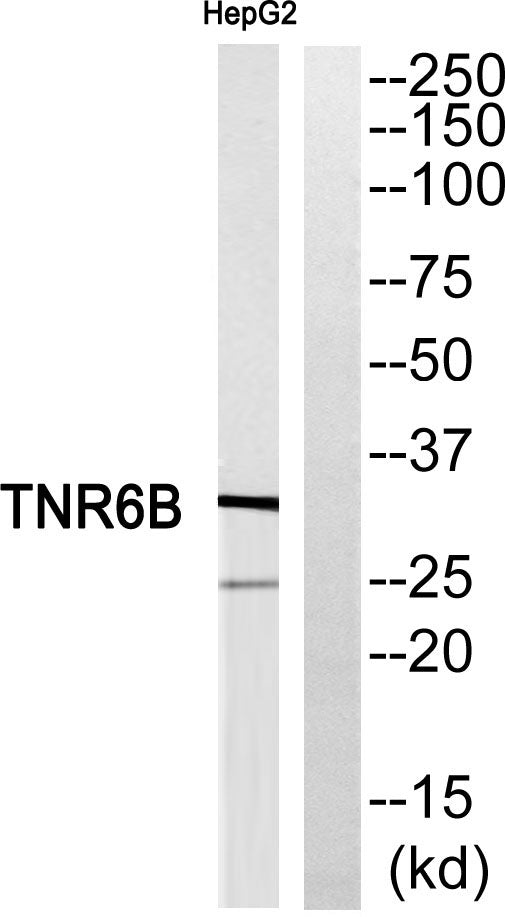 DcR3 Rabbit Polyclonal Antibody
