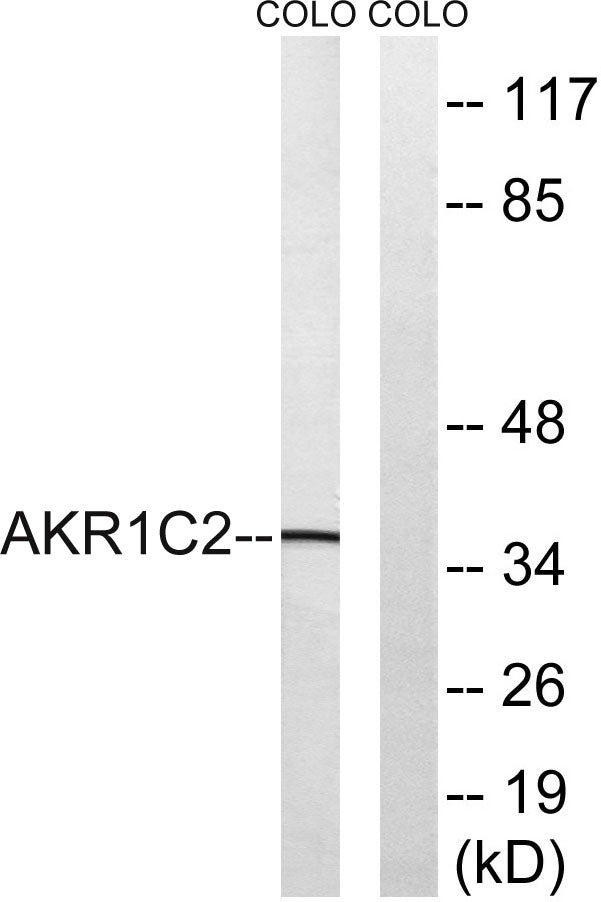 DD2 Rabbit Polyclonal Antibody