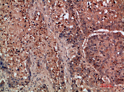 DDR2 Rabbit Polyclonal Antibody