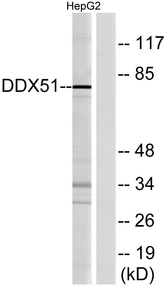 DDX51 Rabbit Polyclonal Antibody