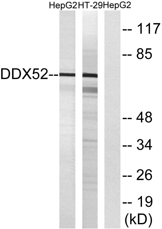 DDX52 Rabbit Polyclonal Antibody