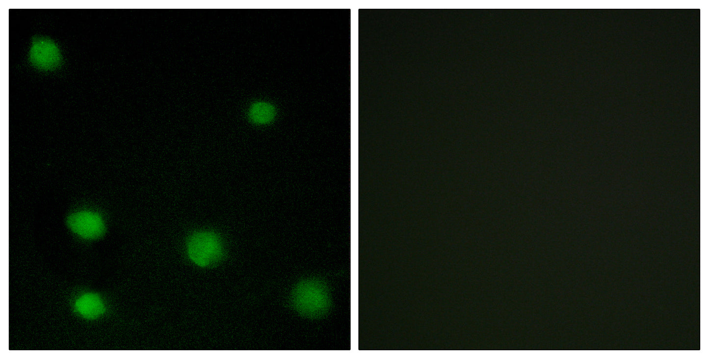 DEF-3 Rabbit Polyclonal Antibody