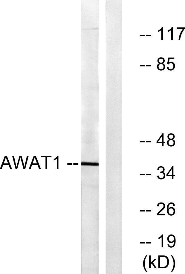 DGAT2L3 Rabbit Polyclonal Antibody